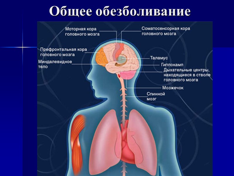 Общее обезболивание